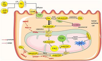 Lipotoxic Proximal Tubular Injury: A Primary Event in Diabetic Kidney Disease